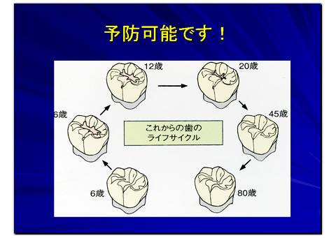 予防可能