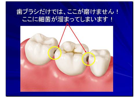 磨けない位置